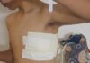 Ataque al estudiante del Colegio Ciudad: habrá cámara Gesell y ya son cuatro los detenidos